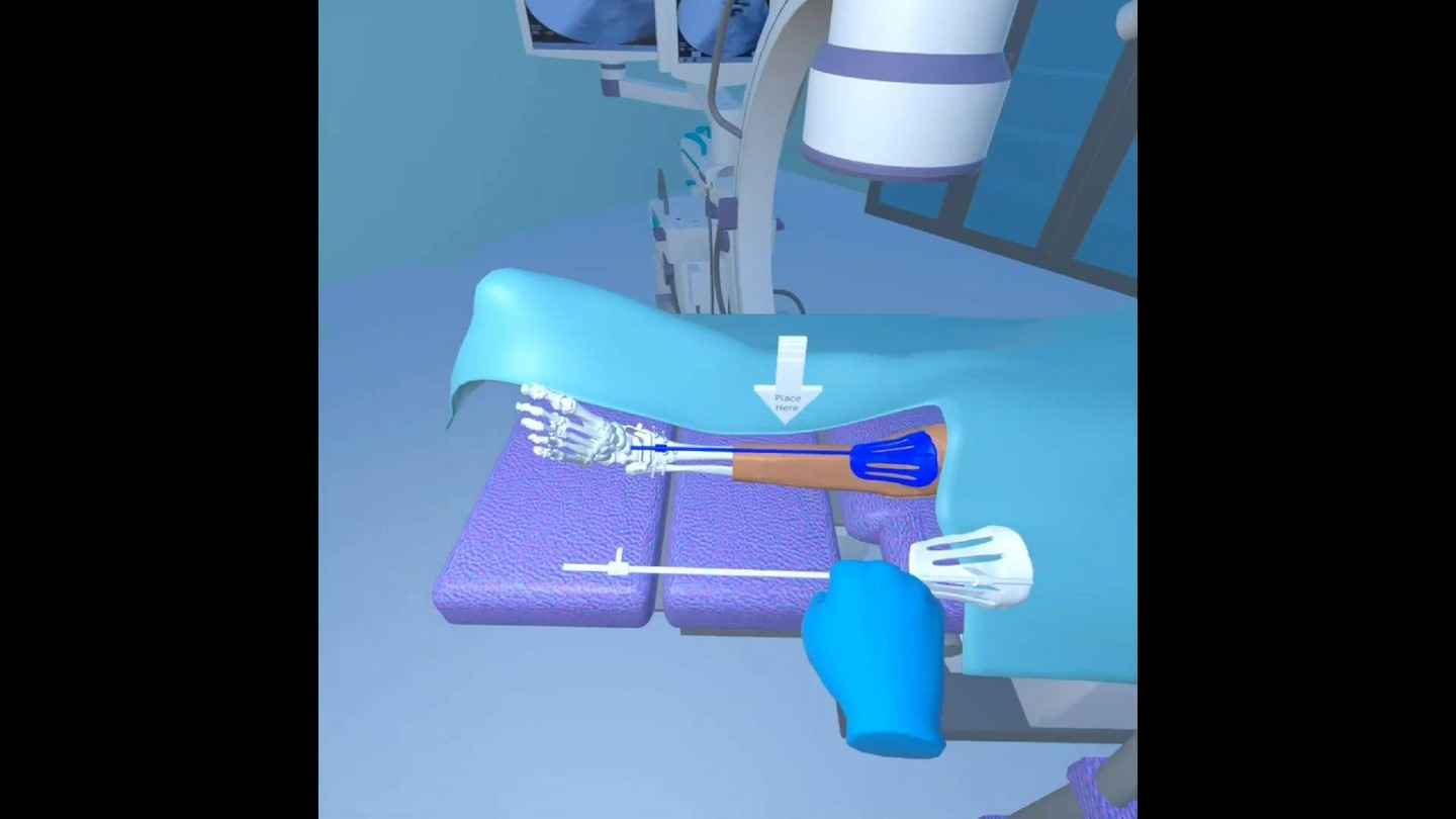 《3d手术》3d surgical