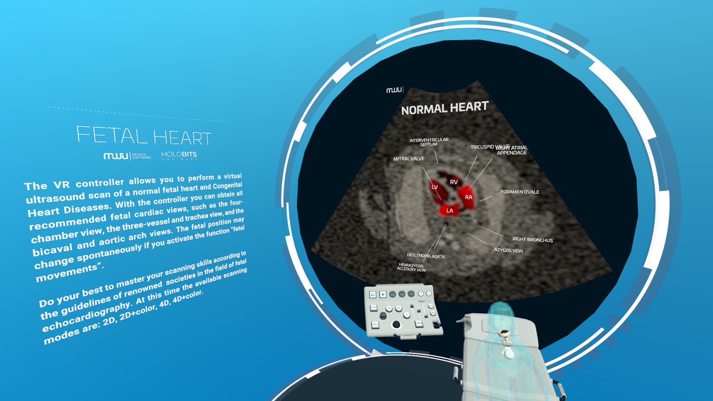 《心脏病医学VR》Fetal Heart VR 未分类 第2张