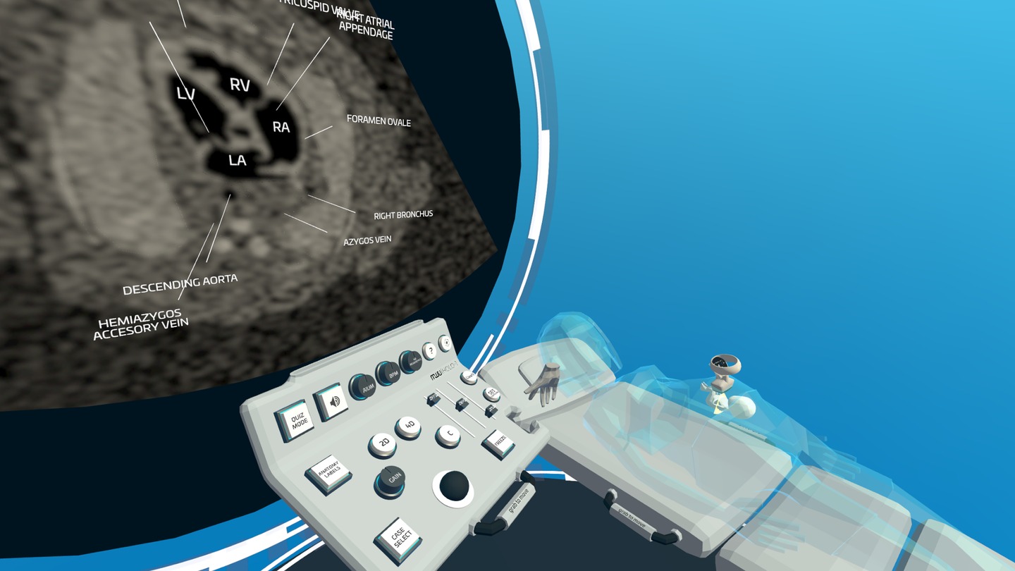 《心脏病医学VR》Fetal Heart VR 未分类 第3张