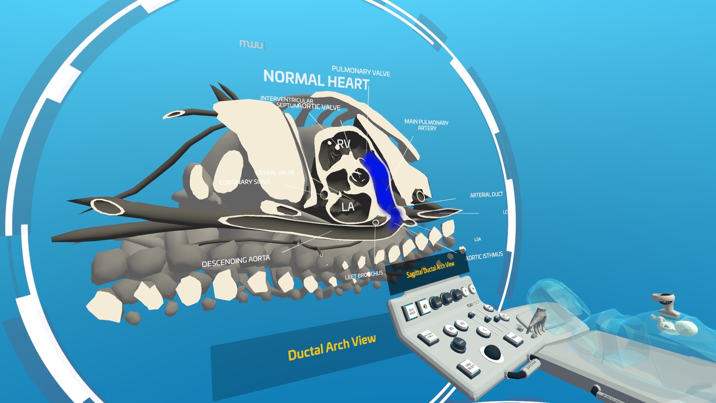 《心脏病医学VR汉化版》Fetal Heart VR