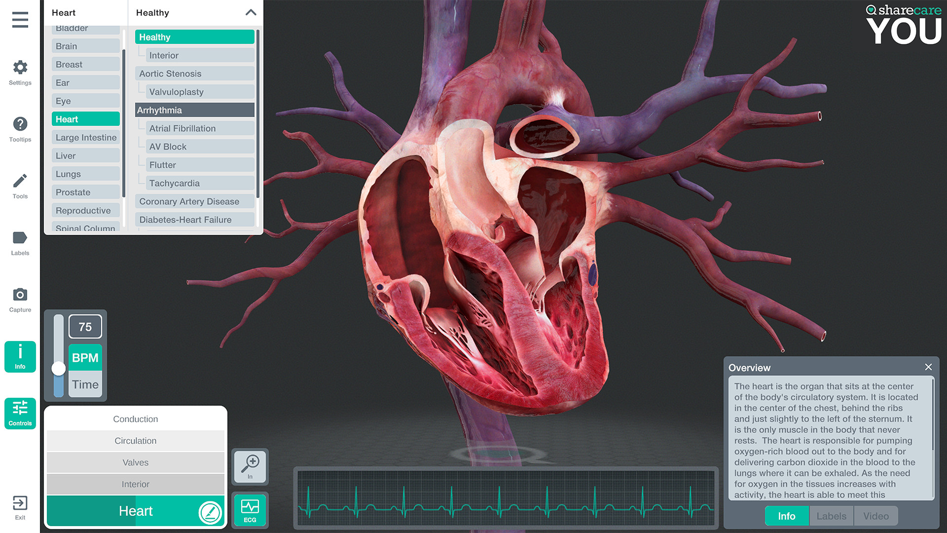 《器官解刨学》Sharecare YOU Anatomy VR