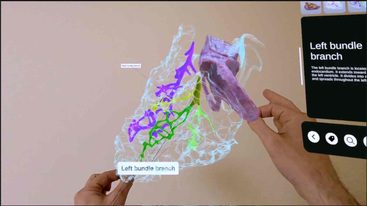 《XR 心脏解剖》XR Heart Anatomy